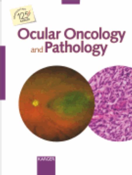Ocular Oncology and Pathology